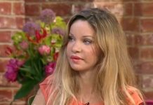 Žali zbog 350 plastičnih operacija: Plastična hirurgija mi je uništila život. Plastična hirurgija