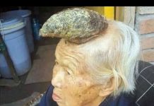 Babi na glavi izbio životinjski rog!