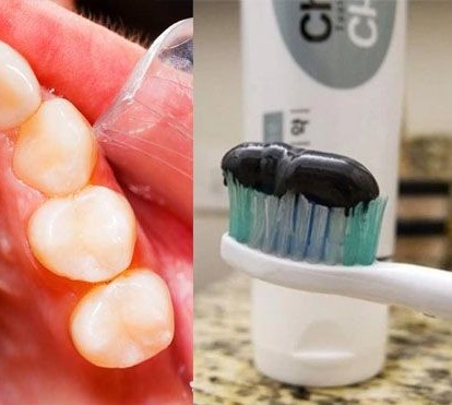 REVOLUCIONARNA PASTA ZA ZUBE: Ostaviće zubare bez posla