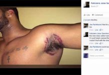 DA LI ĆETE I DALJE KORISTITI OVAJ POPULARAN DEZODORANS? - Zbog osipa i opekotina korisnici tuže proizvođača