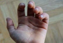 Da li je to sudbina ili ko zna šta li je: ZAŠTO IMAMO LINIJE NA DLANU?