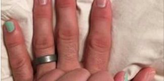 Njen muž stalno lakira mali prst na levoj ruci: Razlog je milione dirnuo u srce