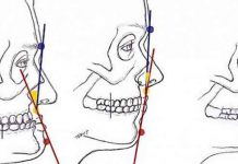 OTKRIJ ŠTA PROFIL GOVORI O TEBI: Istaknuto čelo imaju dobrice, uvučenu bradu oni sa kratkim fitiljem